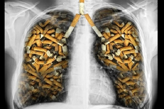 Các chất độc hại trong thuốc lá làm tê liệt phổi.