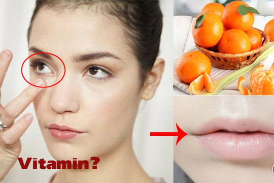 Những biểu hiện trên gương mặt cảnh báo cơ thể thiếu vitamin