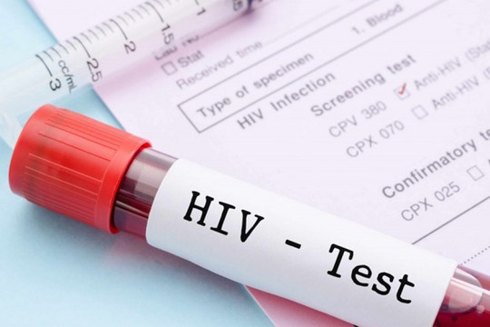 Số người nhiễm HIV ở Việt Nam tăng trong 6 tháng đầu năm
