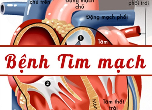 Bệnh tim mạch đang có xu hướng tăng nhanh và trẻ hóa tại Việt Nam