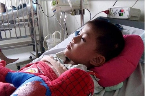 Bé trai 6 tuổi bị ong đốt nhập viện đã qua cơn nguy kịch