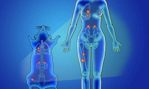 Nano quang học có thể phát hiện sớm 100 loại ung thư