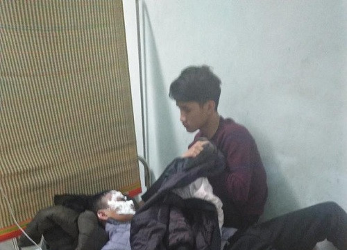 Nghịch dại bình xăng, nam sinh Hà Tĩnh bị bỏng nặng