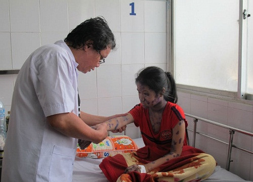 Hà Nam: Dịch thủy đậu bùng phát tại trường học