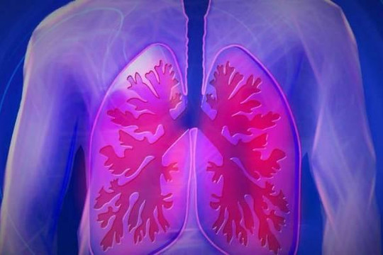 Ô nhiễm không khí gây bệnh phổi, nguy hại sức khỏe