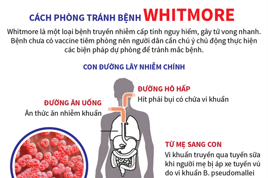 [Infographic] Cách phòng tránh bệnh Whitmore