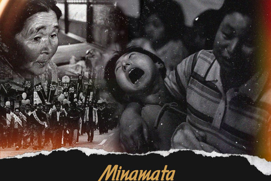 Minamata - Căn bệnh từ thảm họa ngộ độc thủy ngân vô tiền khoáng hậu trên thế giới - Tạp chí điện tử Môi trường và Cuộc sống