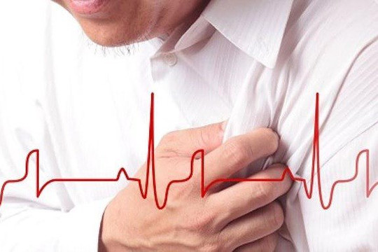 Nhận biết cơn đau thắt ngực đe dọa nhồi máu cơ tim?