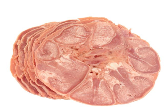 Pháp: 8 người bị nhiễm vi khuẩn nguy hiểm Listeria sau khi ăn lưỡi lợn
