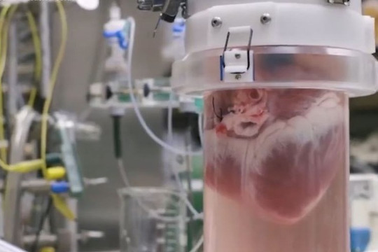 Mỹ: Thử nghiệm thành công thiết bị có thể giữ tim đập đến 24 giờ sau khi lấy khỏi cơ thể