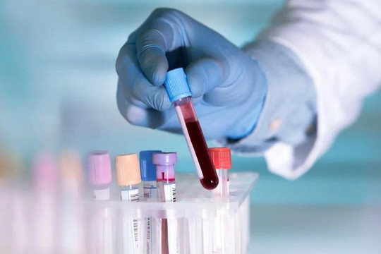 COVID-19: Người nhóm máu nào có nguy cơ dễ nhiễm bệnh nhất?