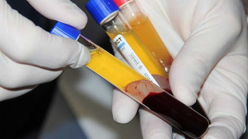 Việt Nam sẽ nghiên cứu sử dụng huyết tương  bệnh nhân khỏi bệnh điều trị Covid-19