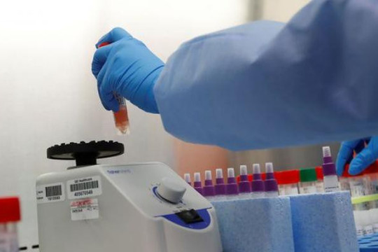 Mỹ cho phép xét nghiệm nước bọt để phát hiện virus SARS-CoV-2