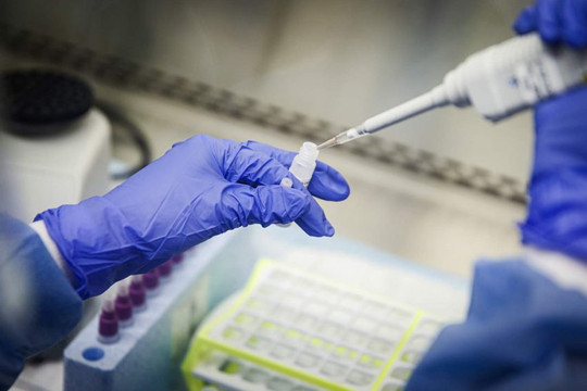Bỉ bắt đầu sản xuất bộ xét nghiệm phát hiện kháng thể chống lại SARS-CoV-2