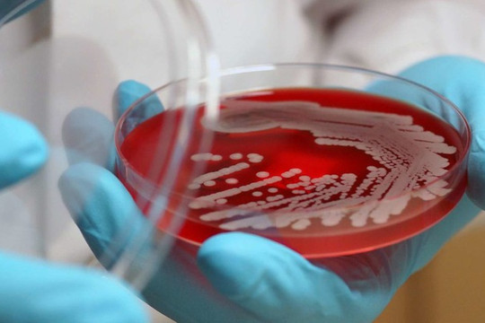 Mỹ: Phát hiện chất đặc biệt có thể tiêu diệt siêu vi khuẩn kháng thuốc