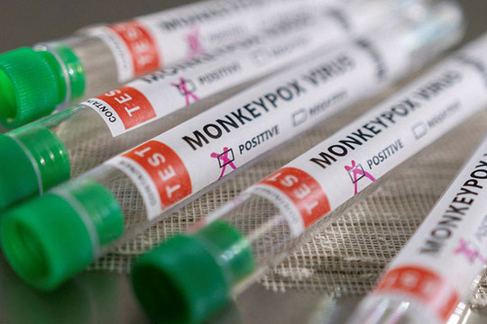 Tổ chức Y tế thế giới: Bệnh đậu mùa khỉ không gây nguy cơ nghiêm trọng đối với y tế toàn cầu