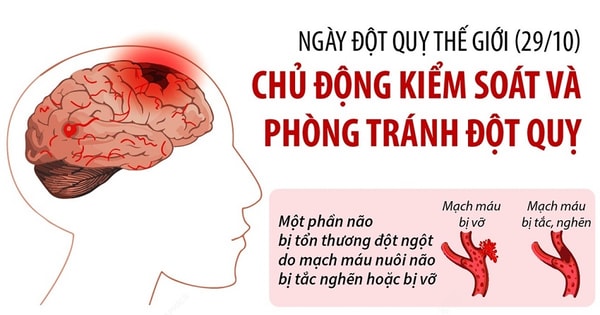 [infographics] Ngày Đột Quỵ Thế Giới 29 10 Chủ động Kiểm Soát Và