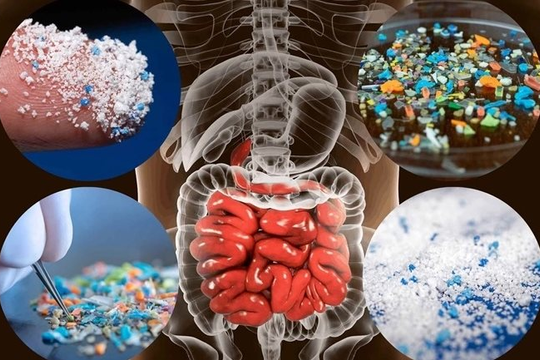Nghiên cứu mới: Người dân Đông Nam Á có nhiều vi nhựa trong cơ thể nhất