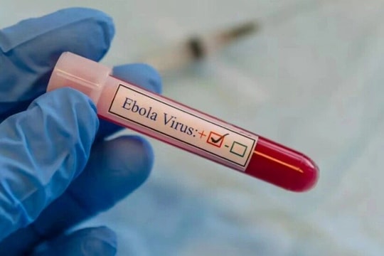 Công văn hỏa tốc của Bộ Y tế về phòng chống dịch bệnh do virus Ebola